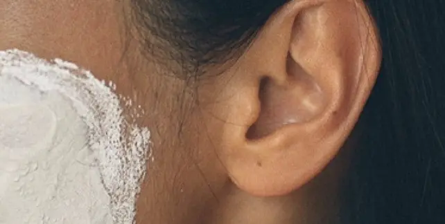 Peeling